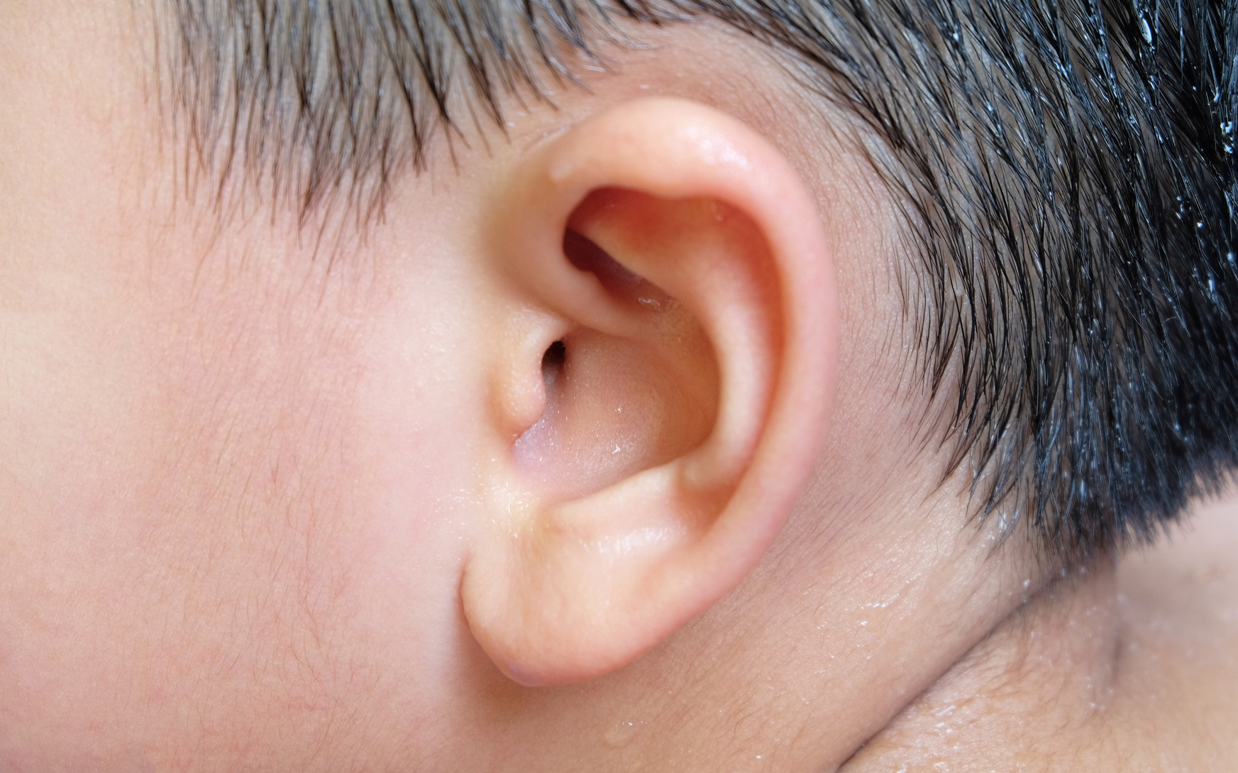 How To Make A Homemade Ear Wick Swimmer's Ear